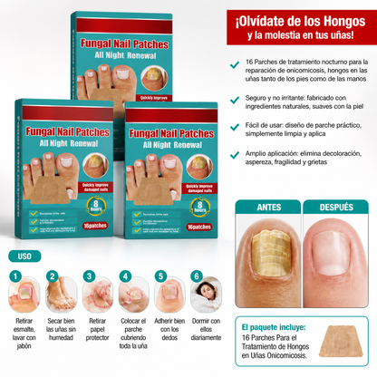 NailRenew™ Parche Antihongos - 48 unidades (Lleva 3 Paga 1)